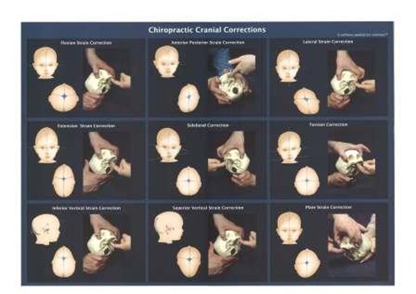 Cranial Corrections Chart