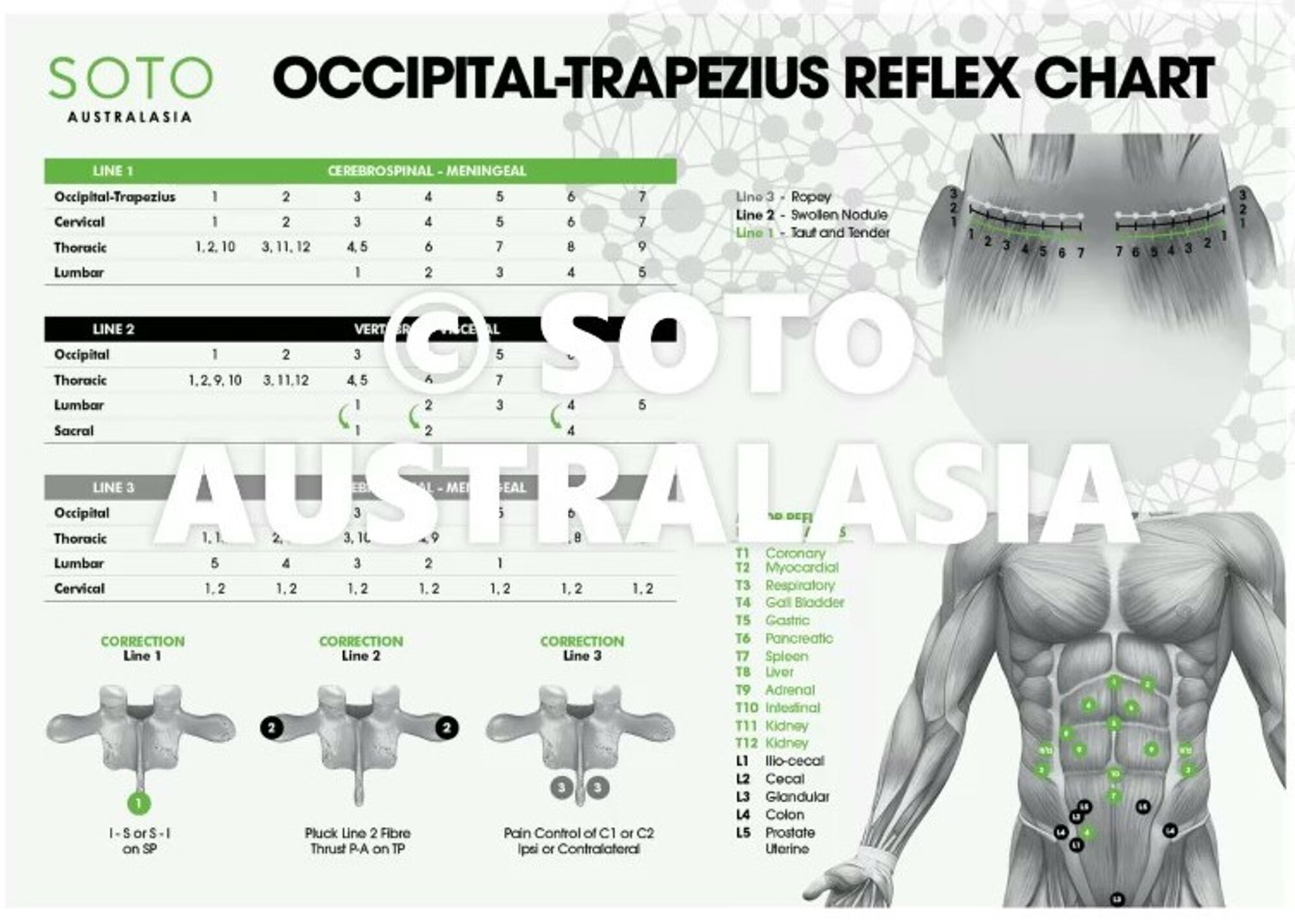 SOTO A CMRT Reflex Chart - A2 | SOTO Australia